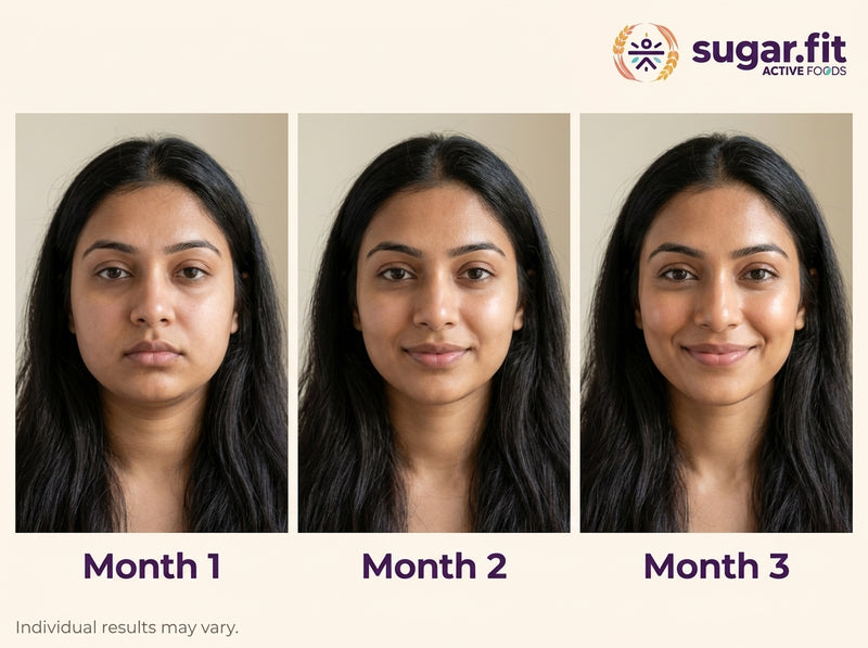 Cheekbones before → after
